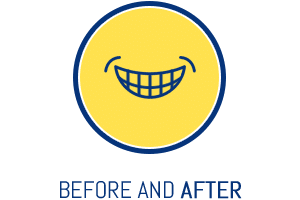 Before and After Dionne Orthodontics Tecumseh ON